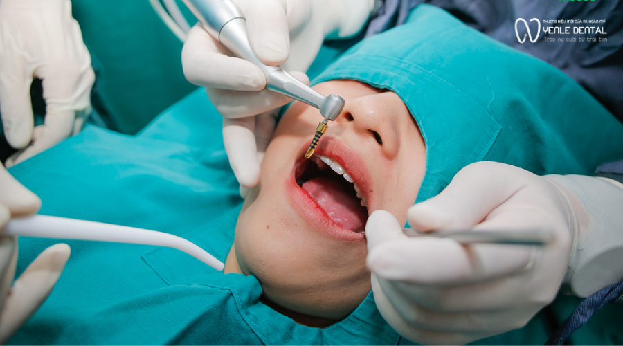 trồng răng implant